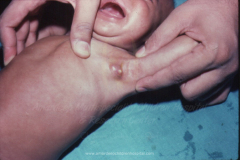 1_tumors-and-masses-1