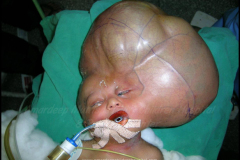 1_tumors-and-masses-13