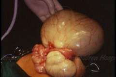 1_tumors-and-masses-3