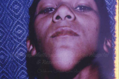 1_tumors-and-masses-4