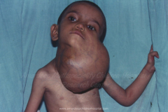 1_tumors-and-masses-5